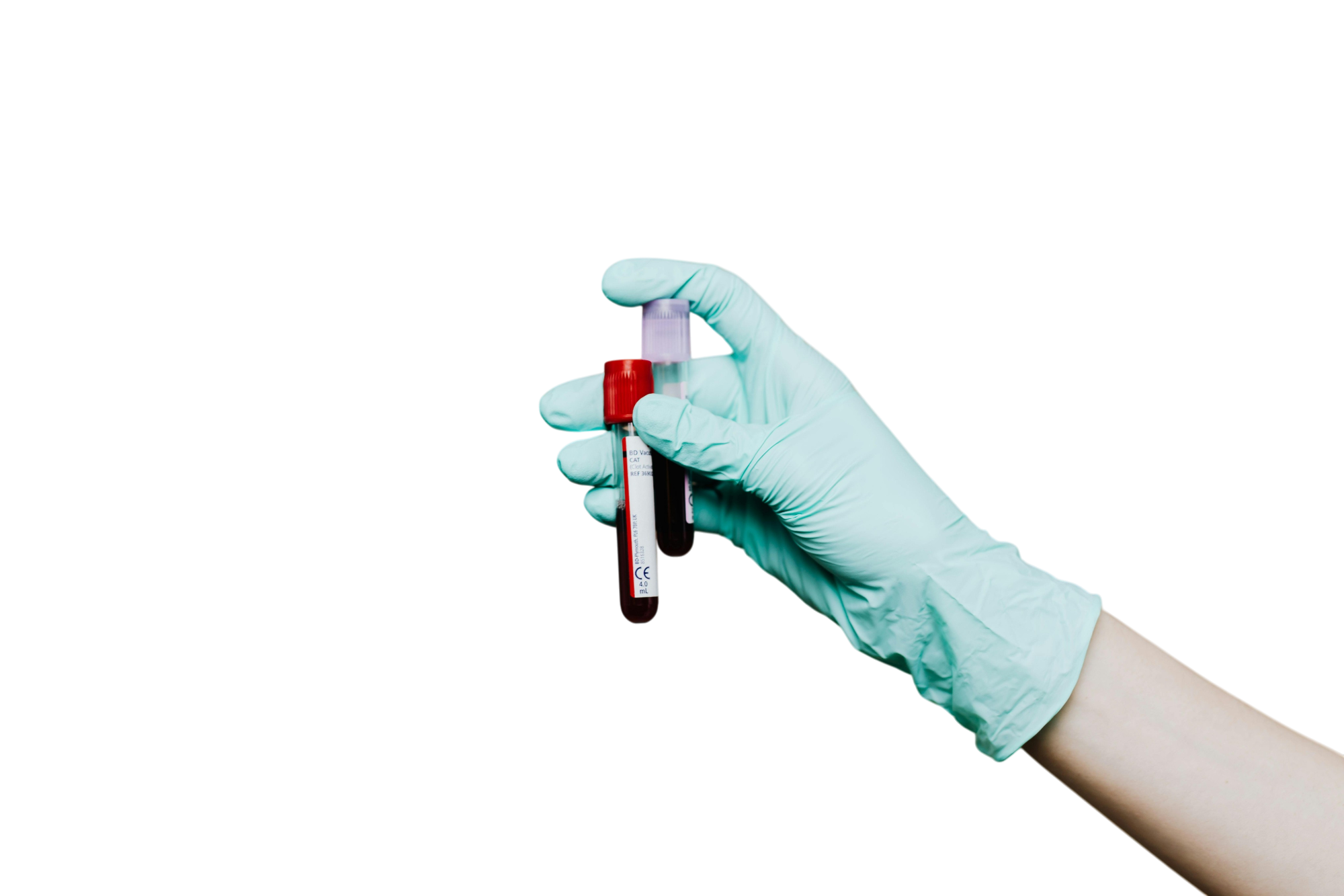 Анализ на иммунитет к гепатиту Б в Москве