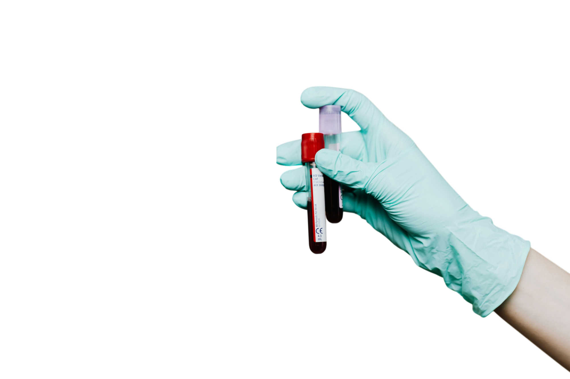 Анализ крови на общий белок в Москве