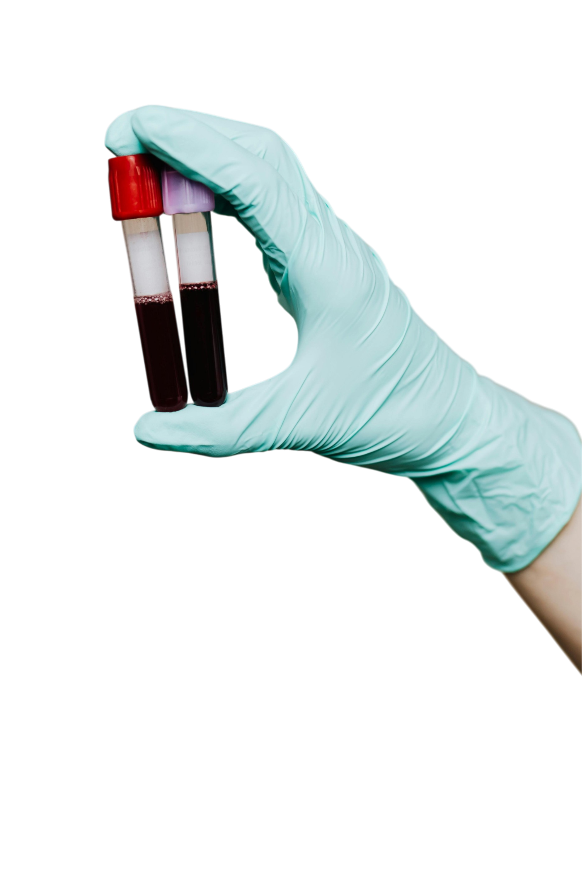 Анализ крови на креатинин в Москве