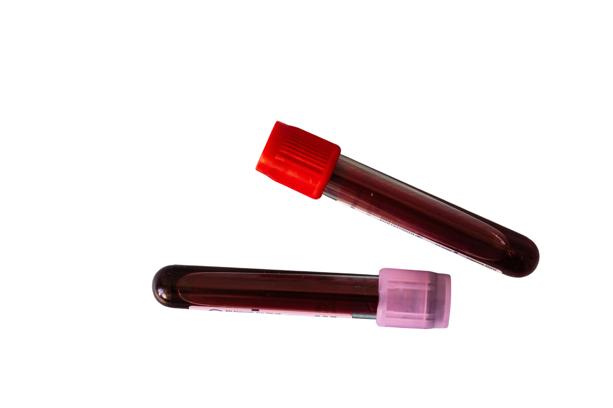 Анализ крови на щелочную фосфатазу в Москве