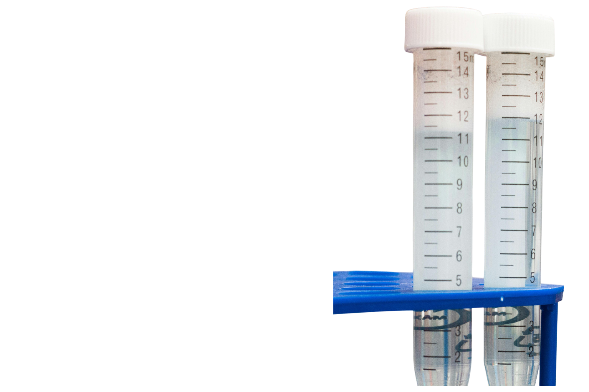 Анализ крови на мочевую кислоту в Москве