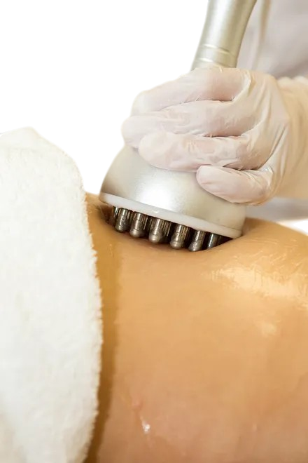 Радиоволновой  RF тела в Москве